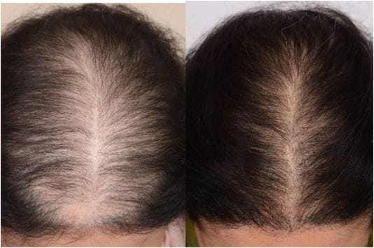 Product review image